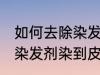 如何去除染发剂染在皮肤上的颜色 被染发剂染到皮肤如何处理