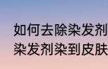 如何去除染发剂染在皮肤上的颜色 被染发剂染到皮肤如何处理